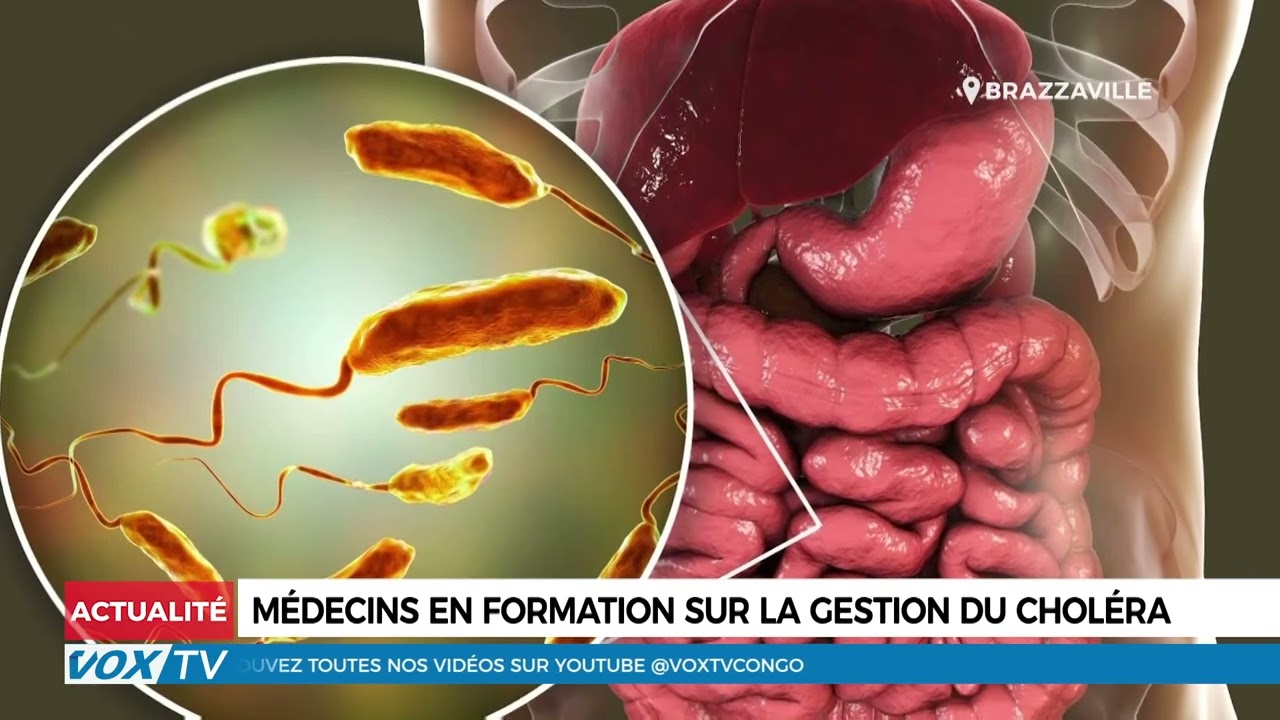 Médecins en formation sur la gestion du choléra